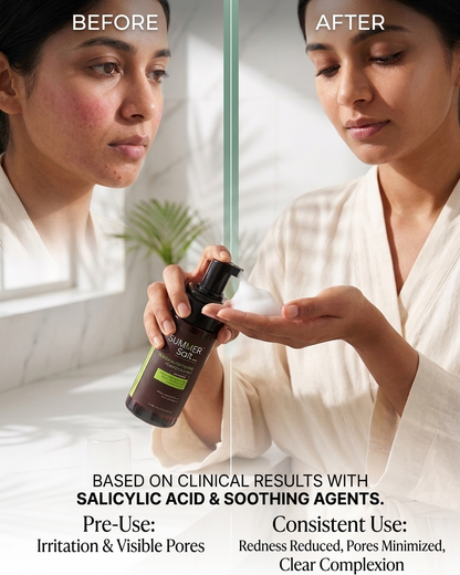 Salicylic Acid Deep Cleansing Foaming Facewash For Acne Prone Skin 100ml