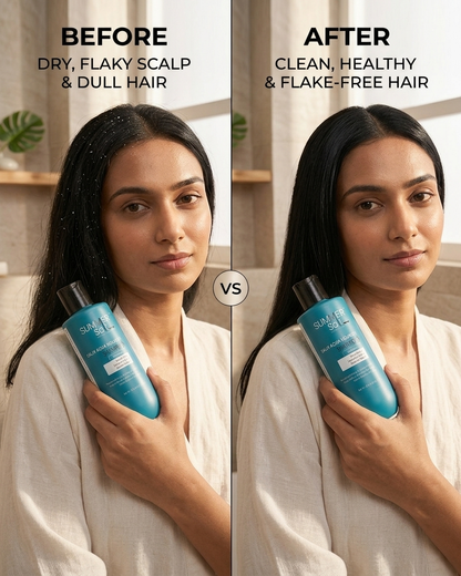 Salicyclic Acid & Sea-Weed Extract Nourishing Shampoo For Dandruff & Hair-Fall Control 250ml